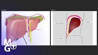 Ligamentul FALCIFORM Anatomie [upl. by Cami]