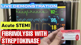 Fibrinolysis with streptokinase in acute STEMI  fibrinolisis pada STEMI serangan jantung berat [upl. by Ck]