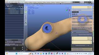 Making new implant connections in an iBar [upl. by Osterhus]