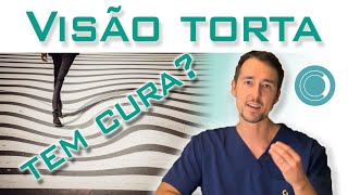 Visão distorcida tem cura Tratamento da metamorfopsia [upl. by Dnarud]