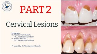 Cervical Lesions  Part 22 [upl. by Okuy]