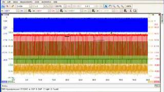 PicoScope 6 Introduction part 4 [upl. by Ahseirej]