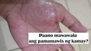 Gamot sa pamamawis ng kamay at paa  Home Remedies [upl. by Razal]