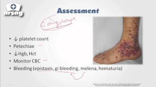 Thrombocytopenia NCLEX® Review  NRSNGacademycom [upl. by Einnhoj]