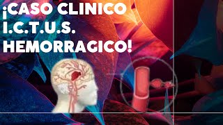 ACV Hemorrágico Un Caso Clínico Real [upl. by Pena670]