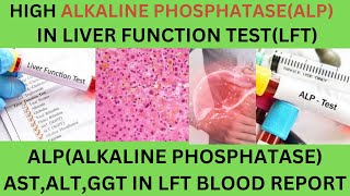 Liver Function Test Report Interpretation LFTsASTALTALP CAUSES OF HIGH LOW ALKAINE PHOSPHATASE [upl. by Adias649]