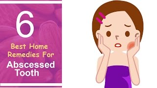 6 Best Home Remedies For Abscessed Tooth [upl. by Weixel]