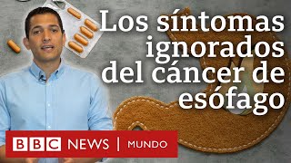 ⚠️ 6 𝗦𝗜𝗡𝗧𝗢𝗠𝗔𝗦 SILENCIOSOS del Cáncer de Colon y Recto Detéctalo a Tiempo [upl. by Laryssa427]