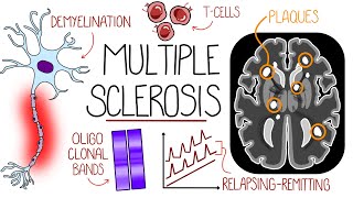 Understanding Multiple Sclerosis Multiple Sclerosis Explained [upl. by Assenar]