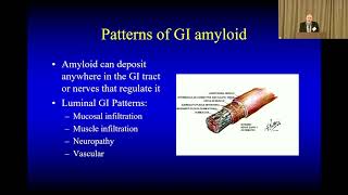 ATTR Amyloidosis amp the Gut GI Symptoms amp Treatments [upl. by Mcroberts]