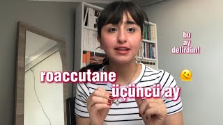 ROACCUTANE ÜÇÜNCÜ AY II BU AY DELİRDİM [upl. by Petronilla515]