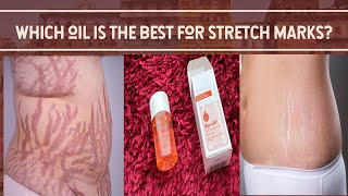 Which oil is the best for stretch marks Best oil for skin care routine🌟Honest Review🌟 [upl. by Fredericka]