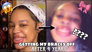 Finally getting my BRACES OFF after 4 LONG years [upl. by Sivle541]