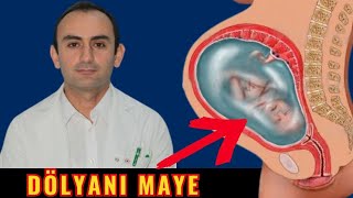 Hamiləlikdə DÖLYANI MAYE  Mayenin çox olması nə qədər təhlükəlidir [upl. by Enomes]