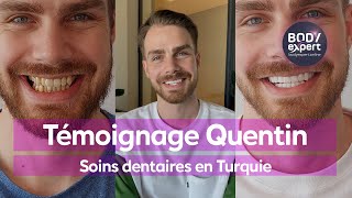 SOINS DENTAIRES EN TURQUIE  🦷 Témoignage de Quentin  24 couronnes Emax  BODYEXPERT [upl. by Larkins]