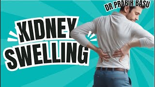 Kidney swelling in stone pain  in Bengali [upl. by Adieno]