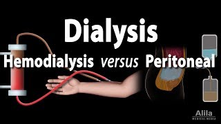 Renal Replacement Therapy Hemodialysis vs Peritoneal Dialysis Animation [upl. by Frodina]