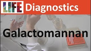 Galactomannan testing for disseminated AspergillusTalaromycesHistoplasma infections [upl. by Byler369]