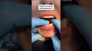 تركيبة متحركه مرنه وثابتهfelix denture drabdullahsultandentist dentist [upl. by Neomah]