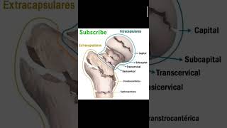 Hip joint anatomy anatomy subscribe support ytshortsindia radiology viralshorts [upl. by Ettelrats]