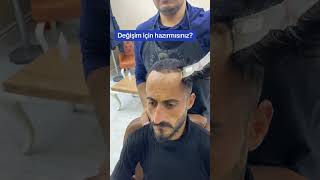 Ön Bölge lokal Protezsaç uygulaması değişim barber kuafor protezsaç protezsac hairstyle [upl. by Clywd72]