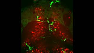 Microglia in the optic tectum at 10 dpf [upl. by Giselle]