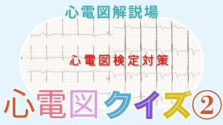 心電図解説場（心電図クイズ②） [upl. by Metah]