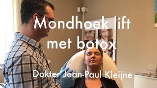 Mondhoeken liften met botox  Art de la Beauté  Dokter JeanPaul Kleijne [upl. by Aileno412]