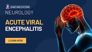 ACUTE ENCEPHALITIS SYNDROME  ACUTE VIRAL ENCEPHALITIS [upl. by Trudey]