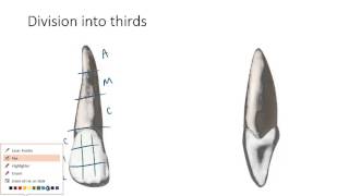 Dental Anatomy 101 Vocabulary [upl. by Annabelle]