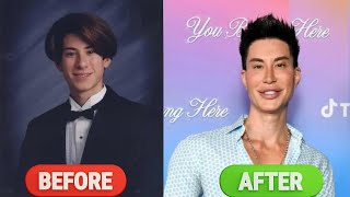 CELEBRITY BEFORE AND AFTER PLASTIC SUERGERY  JUSTIN JEDLICA [upl. by Vocaay208]