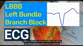 Understanding Left Bundle Branch Block LBBB on ECG Causes Symptoms and Treatment [upl. by Susejedairam675]