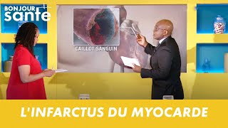 LINFARCTUS DU MYOCARDE  BONJOUR SANTE [upl. by Bradly]