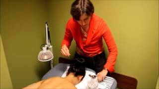 Acupuncture Demonstration and Benefits [upl. by Dahcir]