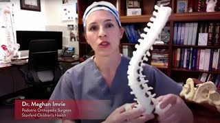 Scoliosis What is it and how is it treated  Stanford Childrens Health [upl. by Zehe]