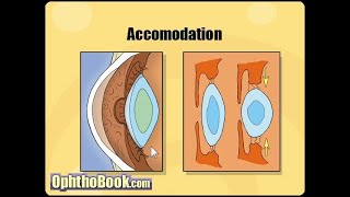 Optometry with Chanaka 11 Refractive Errors Sinhala [upl. by Noryak]