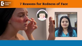 7 Reasons for Redness of Face Erythema Sunburn Rosacea  Dr Urmila Nischal  Doctors Circle [upl. by Waverley]