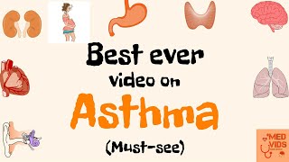 Asthma  Pathology  Med Vids Made Simple [upl. by Sanoy262]