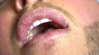 Scalpa Permanent Lips Training [upl. by Wilburn659]