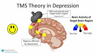 Transcranial Magnetic Stimulation A New Treatment Approach for Psychiatric Disorders [upl. by Einneg980]