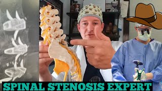 Spinal Stenosis Expert Explains [upl. by Ojeitak]