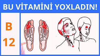 VACİB Halsızlıq yorğunluq varsa B12 vitamini çatışmır [upl. by Guimar117]