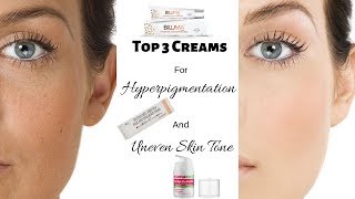 Top 3 Creams For Hyperpigmentation Uneven Skin Tone and Dull Skin  Rabia Skin Care [upl. by Yemarej]