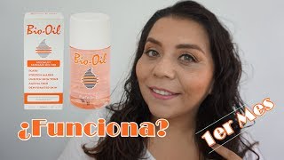 Reseña TODO SOBRE BIO OIL ¿Cómo eliminar manchas cicatrices y estrías [upl. by Okihcim]