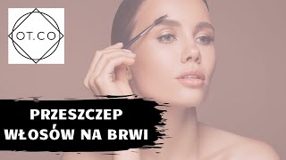 Przeszczep Brwi jak zrobić piękniejsze brwi  OTCO Clinic [upl. by Ahsekat]