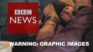 BBC goes undercover inside Americas heroin epidemic  BBC News [upl. by Adnamahs]