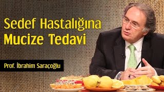 Sedef Hastalığına Mucize Tedavi  Prof İbrahim Saraçoğlu [upl. by Odysseus697]