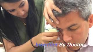 Instructional Video Contact Lens Insertion and Removal Scleral Lens [upl. by Arutak]