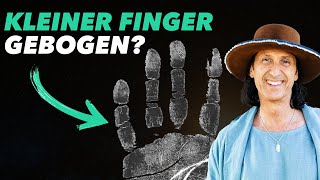 Die schockierende Wahrheit hinter dem kleinen gebogenen Finger [upl. by Virgilia]