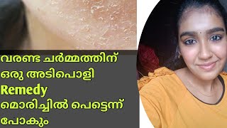 വരണ്ട ചർമം അകറ്റാൻ Get Rid Of Dry Skin Naturally At HomeMalayalam [upl. by Brion]